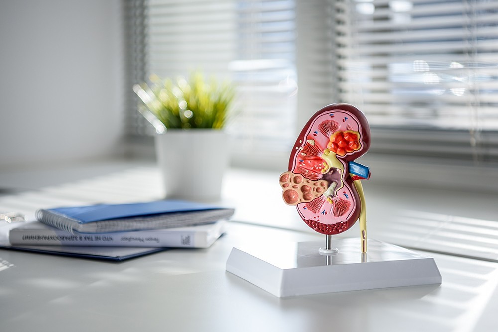 Дистанционная ударно-волновая литотрипсия: лечение мочекаменной болезни без операции в клинике «Консилиум»