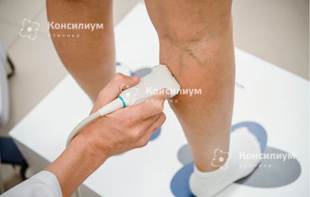 Варикозное-расширение-вен.jpg Варикозное-расширение-вен.jpg