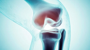 «Инженерная проверка» вашего тела! Почему чекап «Костная система» – залог вашей активности