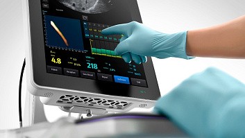 Новый уровень диагностики в клинике «Консилиум»: эластометрия на УЗИ-аппарате экспертного класса