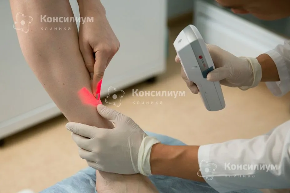 Рекомендации при варикозе во время беременности | Клиника «Консилиум ...